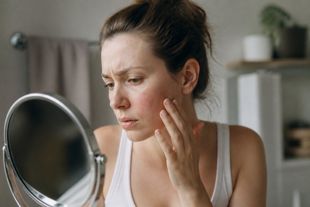 Signs of a weak skin barrier: What to look for